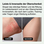 Intertrigo Creme